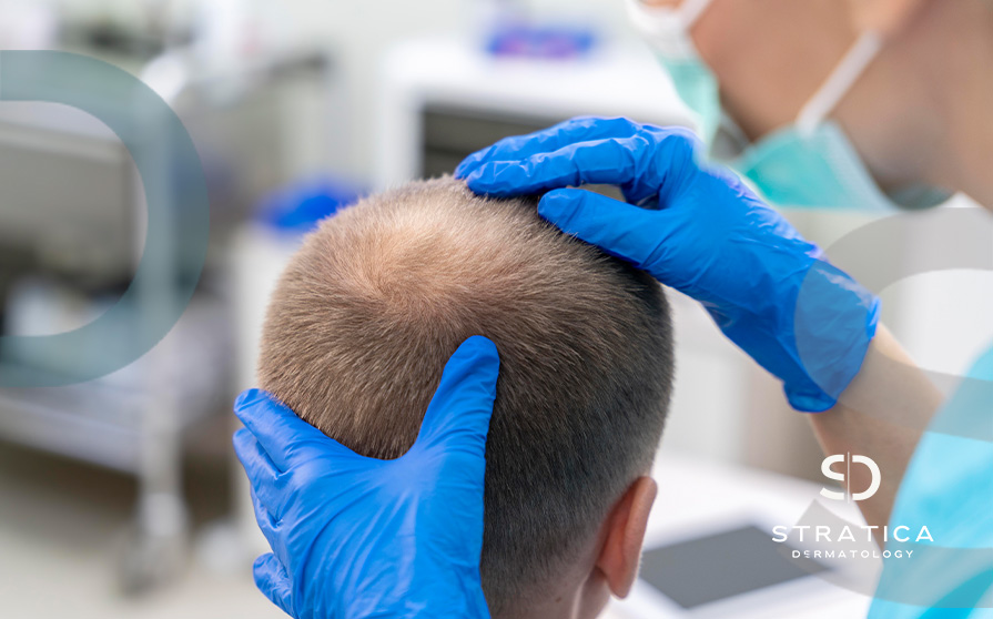PRP for Hair Loss - Stratica Dermatology