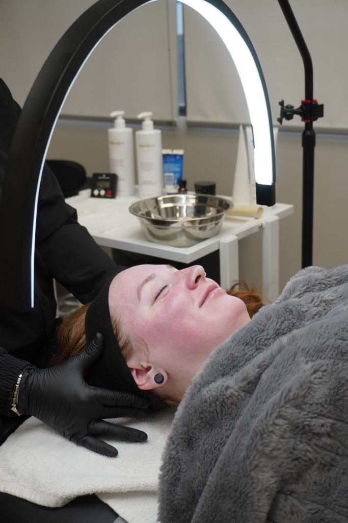 Chemical Peel in Edmonton