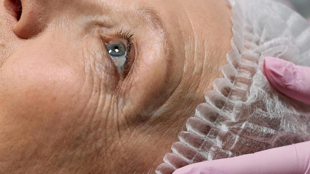 wrinkles treatment and care