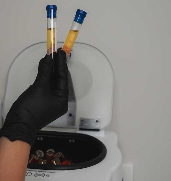 cosmetic-services---PRP-for-Facial-Rejuvenation prp for facial rejuvenation stratica dermatology