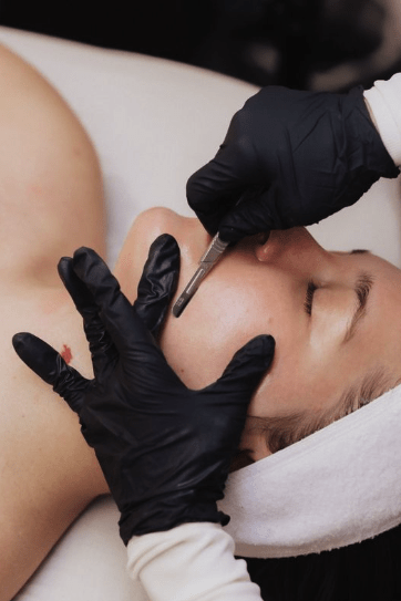 image (12) botox stratica dermatology anti wrinkle treatments
