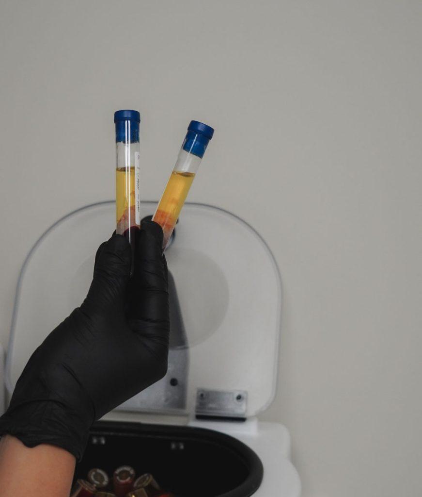 prp for facial rejuvenation stratica dermatology edmonton