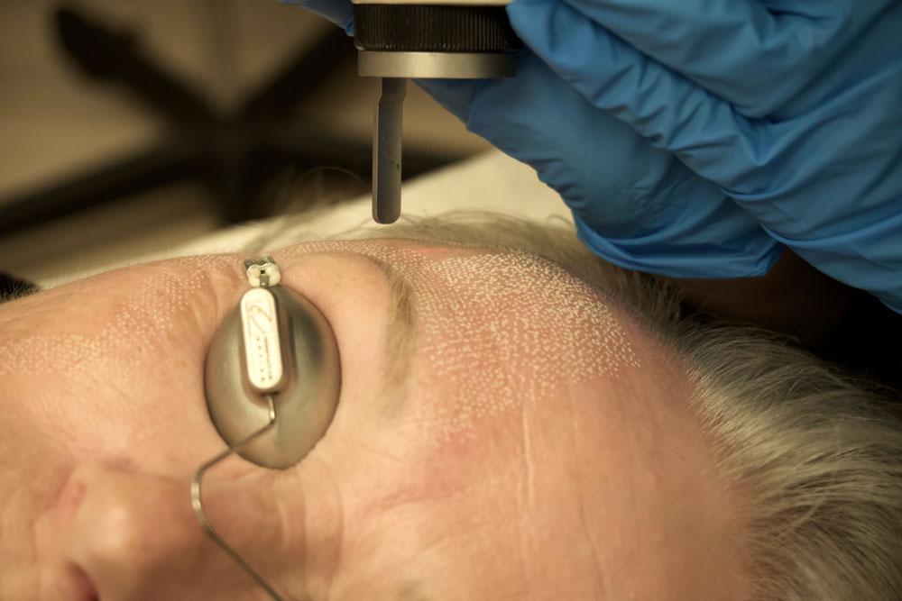 stratica-dermatology-laser-treatment2-homepage stratica-dermatology-laser-treatment2-homepage