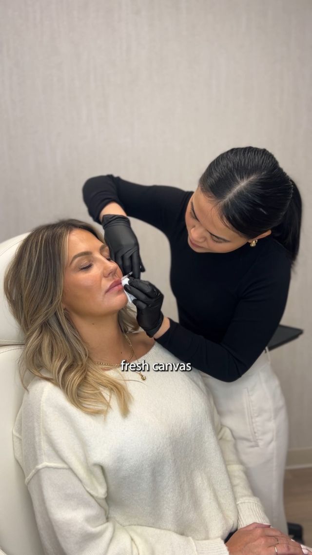 Refining your filler journey often includes dissolving filler. This treatments aids in addressing migration and offers your lips a fresh canvas for a refill 💋

Interested in chatting about your unique filler treatment plan? Schedule a complimentary consultation with Nurse Trish via the link in bio.

#StraticaDermatology 

#LipFiller #FillerDissolving #Lipshaping #Edmontonlipinjections #Edmontonlipfiller #fillerdissolve #facialbalancing #lipfiller #nurseinjector #yegnurseinjector #edmontonnurseinjector #edmontondermatologist #fillerinjections