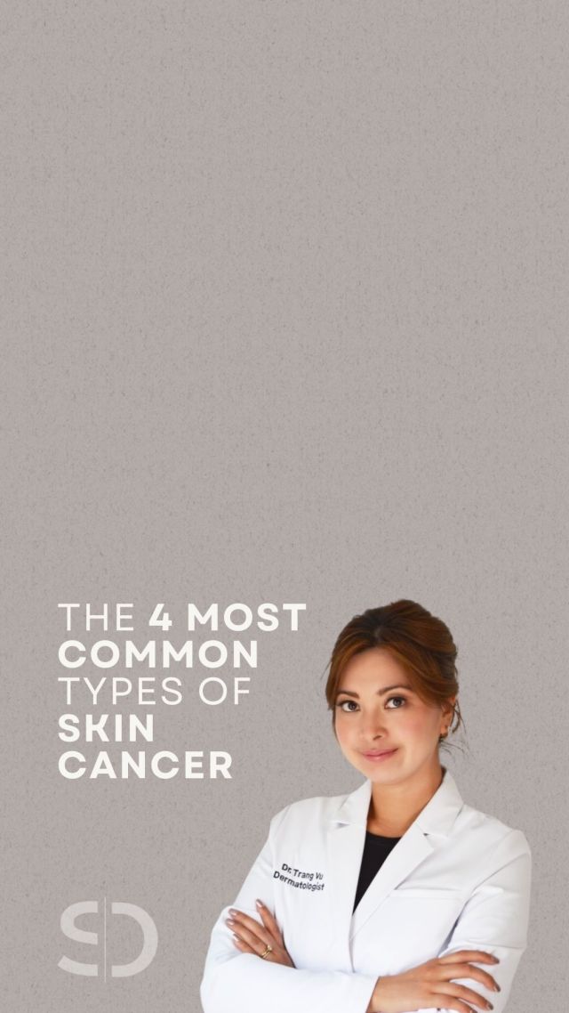 Let’s break down the 4 most common types of skin cancer! Don’t forget to schedule your derm check - summer’s here, and it’s time to keep an eye on those moles, spots, and freckles! ☀️✨ #skincancer #dermatology #skincare #dermatologist #skincareroutine #yeg
