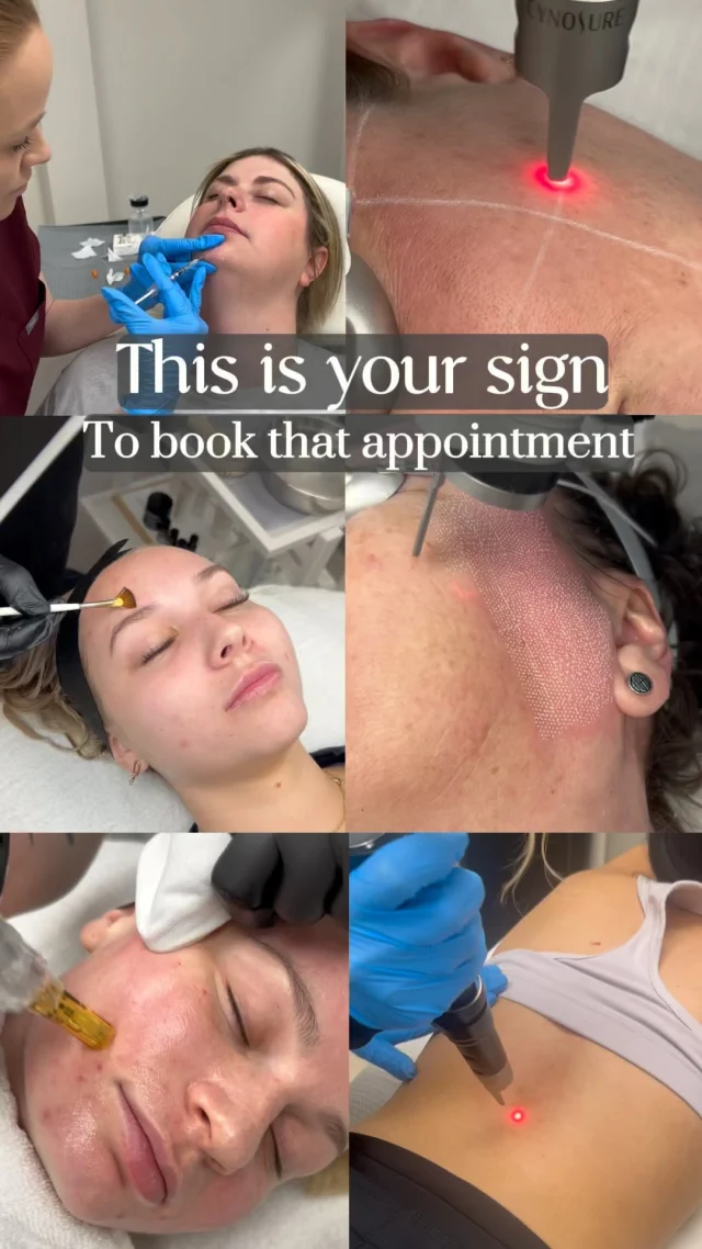 ✨This is your sign to book that appointment ✨ 

P.S. Did you know that you can get exclusive discounts on these treatments when you join our SKIN CLUB MEMBERSHIP? 👀 Check out the link in our bio! 

#yegcosmetics #yegskincare #yegskintreatments #yeglaser #yegchemicalpeel #pigmentationtreatment #yegacnetreatment