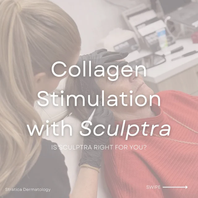 Here’s everything you need to know about our newest collagen-stimulating treatment: ✨ Sculptra ✨ 

🌟 Sculptra is a biostimulator that is injected under the skin which helps smooth out wrinkles and fine lines and adds volume to certain areas of the face. 

🌟 Once injected, it stimulates your body’s natural collagen production, helping your cells restore structure and volume for a smoother, more refined complexion gradually over time.

🌟 Effects of this treatment are typically seen after 2-3 treatment sessions spaced a few months apart. 

🌟 Getting to that Sculptra glow means long-lasting results for up to two years—or even longer!

Our double-board certified dermatologist, Dr. Malika Ladha, and our registered nurse injector, Kate Cameron, both offer Sculptra treatments. With their expertise, you can achieve long-lasting results tailored to your unique needs 🫶🏼🙌🏻

Schedule a complimentary consultation with us to discuss if this treatment is right for you! 💕☺️ 

Book online, DM, or call us at 587-410-4295 📲